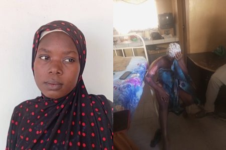 Pregnant Woman Burned with Hot Water by Sister-in-Law in Adamawa