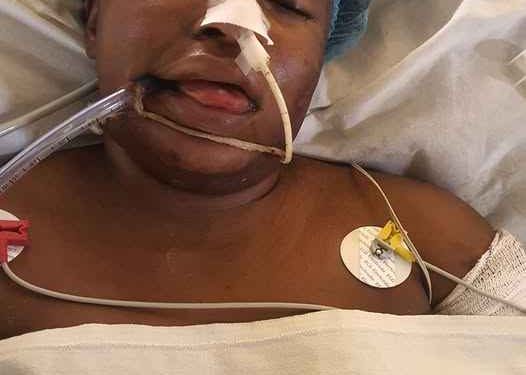 Lost But Found!!! Woman Hospitalized After She Was Spotted Lying Unconscious By The Roadside in Abuja