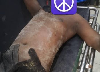 Tragedy in Lagos: Several Injured as Building Collapses Overnight in Isale Eko