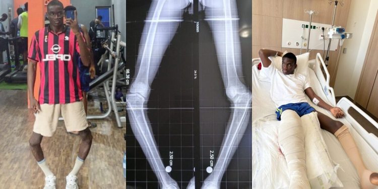 Complications arise as popular influencer undergoes successful first-stage surgery