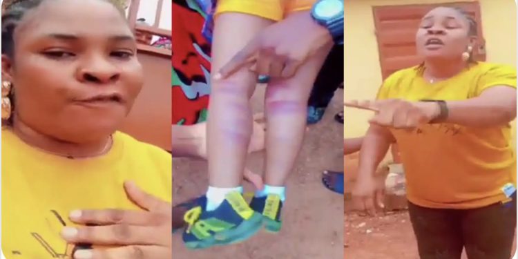 PHOTO: Mother calls for justice as teacher brutalizes 3-year-old daughter in Enugu