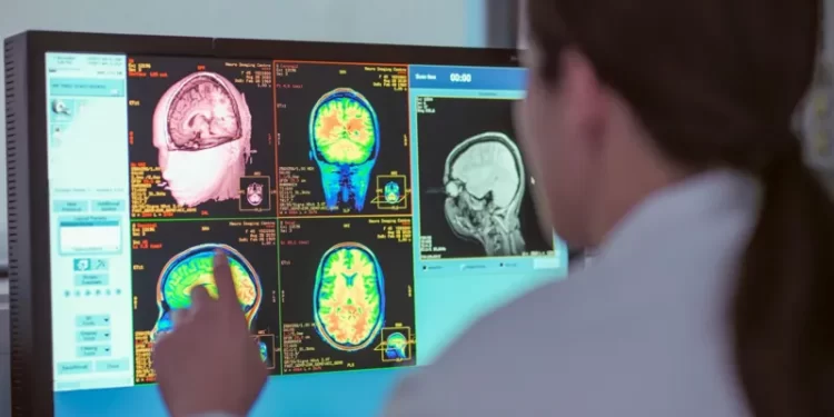 New Research Shows the Brain Has Four Major Turning Points and Adolescence Lasts Far Longer Than Expected