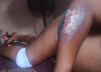 Bandits attack farmers in Kwara, kill brothers