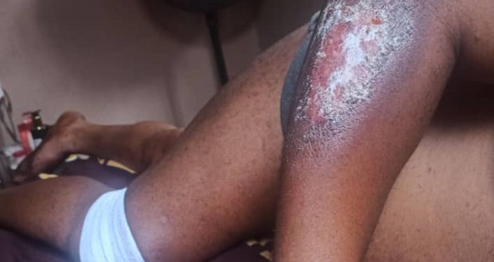 Bandits attack farmers in Kwara, kill brothers