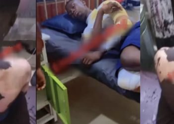 Horror!!! UNIZIK student allegedly pours hot water on lodge mate following sexual assault allegation