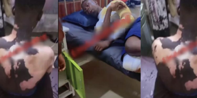 Horror!!! UNIZIK student allegedly pours hot water on lodge mate following sexual assault allegation