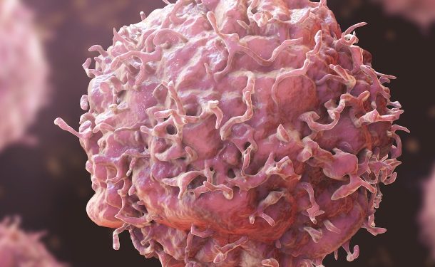 Cancer Claims Over Half of Nigerians Diagnosed Annually – Project Pink Blue