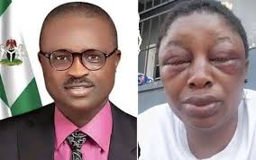 Popular Nigerian lawmaker suspended after beating lady to stupor