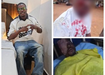 Outrage as Man Allegedly Loses Eye After Police Brutality in Ebonyi