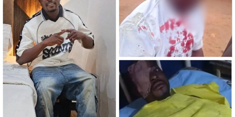 Outrage as Man Allegedly Loses Eye After Police Brutality in Ebonyi