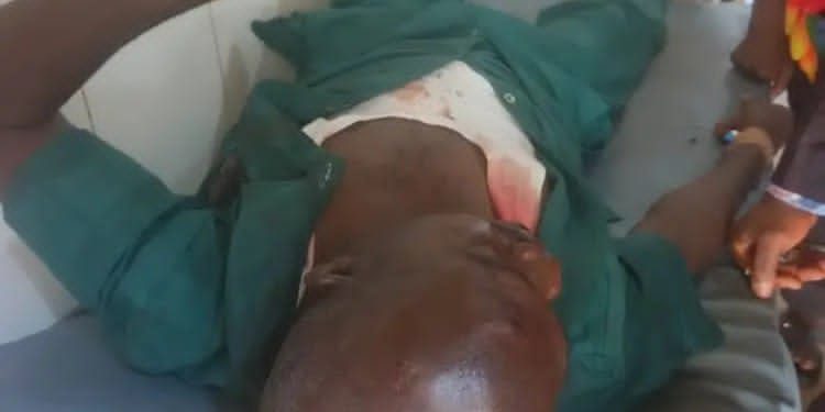 Oil field dispute: Ex-Delta APC treasurer beaten to coma